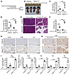 Transgenic expression of human PRSS1R122H caused severe AP.