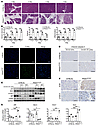 Progressive pancreatic damage and activation of stress signaling pathways i