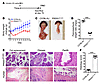 CP developed in transgenic PRSS1R122H mice.