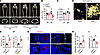 Sensory nerve denervation induces adipogenesis of MSCs at the expense of os