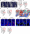 Impairment of EP4 sensory nerves interrupts bone fracture healing.