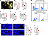 Loss of sensory nerves potentiate adipogenesis.