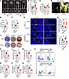 Deletion of the EP4 receptor in sensory nerves promotes adipogenesis and in