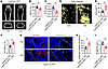 Capsaicin-induced sensory nerve denervation promotes adipogenesis and inhib