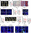 Impairment of EP4 sensory nerves promotes adipogenesis and attenuates bone