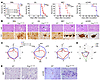 Survival and histopathologic lesions in prion-infected Prnp180Q/196Q and WT