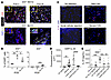 Augmented IL-33 is observed in allografts and the circulation during heart