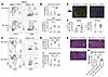 Increased iNOS+ inflammatory myeloid cells cause vasculopathy in IL-33–defi