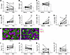 Mirabegron treatment reduces skeletal muscle TGs, but not toxic lipids, and