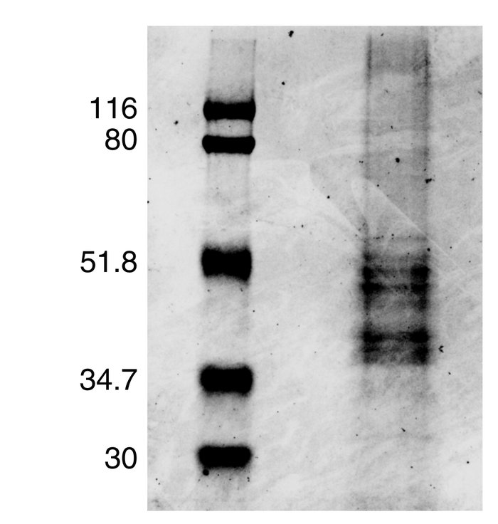 SDS-PAGE separation of affinity-purified H-AChR protein. Standard protei...