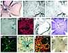 Retinal vascular development in VEGF120/120 mice. (a) PECAM staining at P5.