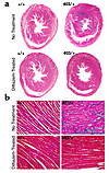 Histopathologic analyses of diltiazem-treated mice. (a) Low-magnification (