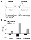 Effects of heterogeneous KCNE3 transduction on the simulated ECG. (a) Simul