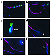 Four-color FISH/immunohistochemistry analyses for codetection of donor-deri