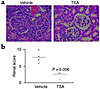 (a) Representative kidney sections stained with H&E from an MRL-lpr/lpr mou