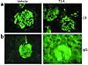 Immunohistochemical analysis of IgG and C3 deposition in the kidneys of MRL