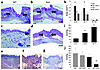 Reduced estrogen has no effect on wound healing in mice null for MIF. Day 3