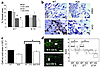 Reduced inflammation in the MIF null wounds. (a) An absence of MIF leads to