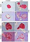 β cell and α cell architecture in Pdx1+/– islets. Insulin (a, c, e, and g)