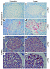 Immunohistochemistry for proapoptotic active caspase-3 and TUNEL. (a–d) Pdx