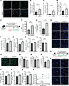 The combination of NAM and PN enhances MuSC function in vivo and increases