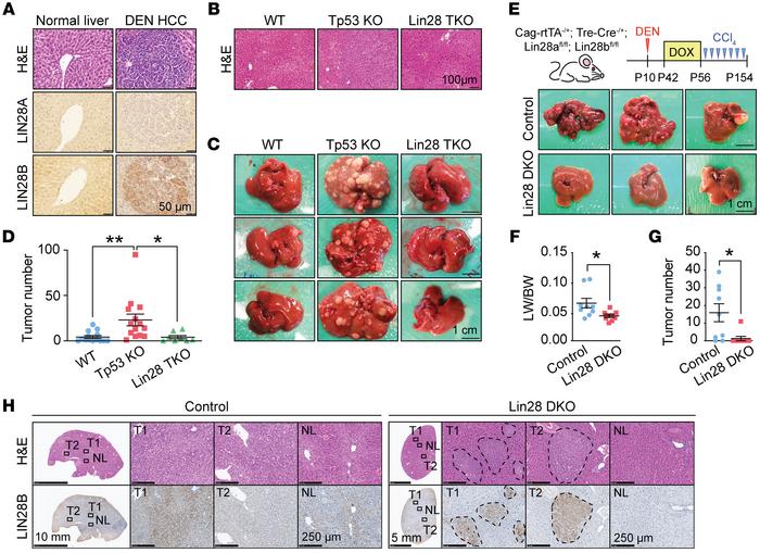 
Lin28-deficient mice are protected from DEN-driven liver tumorigenesis....