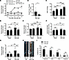 Sexual dimorphism in Aldo-salt–induced AAs.