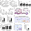 Intraperitoneal injection of anti–PD-1 Ab reinstates Aldo-salt–induced aort