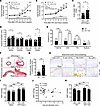 Genetic deletion of PD-1 exacerbates HFD- and Ang II–induced aortopathy.