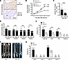 Downregulation of the AR by ASC-J9 in mice inhibits Aldo-salt–induced AA.