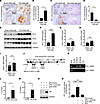 Androgen suppresses PD-1 mRNA and protein expression in the spleen in mice