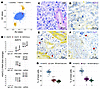 HSAT2,3 RNAs exhibit pathogen-like features and are disseminated in the TME