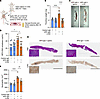 2-DG mitigates APS IgG-induced thrombosis in mice.