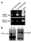 Expression of HIF in BM progenitors and stem cells. (a) RT-PCR analysis of