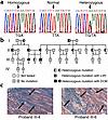 Mutation in the PLN gene and analysis of inheritance in kindred I. (a) Part