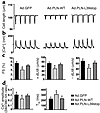 Effect of PLN-L39stop mutant on adult rat cardiac myocyte mechanics and Ca2