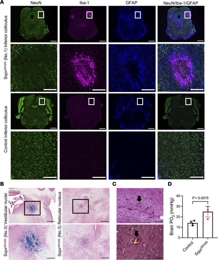 SqorΔN/ΔN mice had neurodegeneration with gliosis, acute and subacute he...