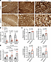 SqorΔN/ΔN mice had decreased complex IV activity, increased systemic H2S le