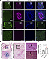 SqorΔN/ΔN mice had neurodegeneration with gliosis, acute and subacute hemor