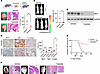 Triptolide reduces tumor growth in G3 MB mouse models.