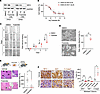 Triptolide attenuates G3 MB metastatic dissemination.