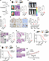 The triptolide prodrug, Minnelide, attenuates G3 MB growth.