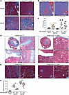 Areg production by Tregs increases allograft fibrosis and vasculopathy.