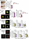 l-DOPA/DDI treatment prevents choroidal neovascularization independently of