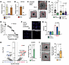 The decarboxylation of l-DOPA to dopamine is necessary for its anti-angioge