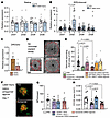 DRD2 activation mediates the CNV inhibition observed under l-DOPA/DDI treat