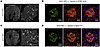 AAV2-GEC maintained robust tropism in BTBRob/ob and Nphs1ΔiPod mice.