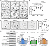 CGRP induces formation of continuous, nonpermeable VE-cadherin LEC junction