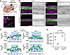 CGRP reduces CSF uptake into MLVs.