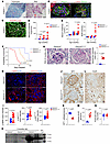 PIK3CA gain-of-function mutation in podocytes leads to severe glomerular di